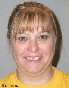 From Good to Beautiful - Before