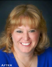 From Good to Beautiful - After