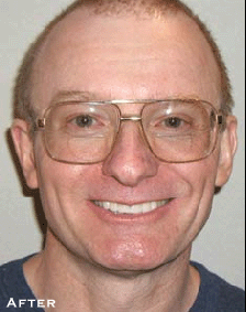 Misshapen & Stained After