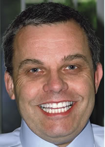 Multiple Spaces Between Teeth - After