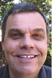 Multiple Spaces Between Teeth - Before