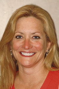 Permanent Whitening & Straightening - After