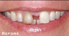 From Good to Beautiful - Before