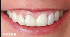 From Good to Bea?��???sutiful - After