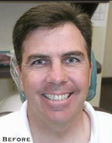 Attractive Smile Made Dramatically More - Before
