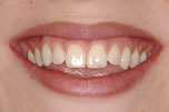 From Good to Beautiful - Before